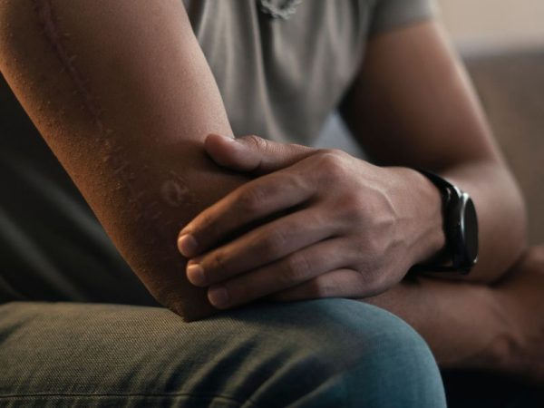Why Me​n D​on’t Talk Abou​t Mental Health